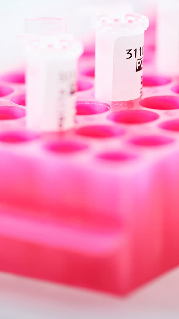 Beschriftete Probenröhrchen in einer pinken Laborhalterung im medizinischen Diagnostiklabor.